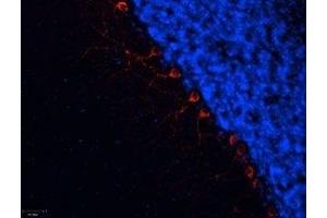 Expression of α1B-Adrenoceptor in rat cerebellum - Immunohistochemical staining of frozen section of rat cerebellum using Anti-α1B-Adrenergic Receptor (extracellular) Antibody (ABIN7042897, ABIN7043914 and ABIN7043915), (1:100). (ADRA1B Antikörper  (Extracellular))