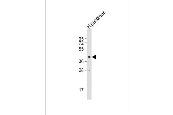 NPTX2 Antikörper  (AA 160-189)