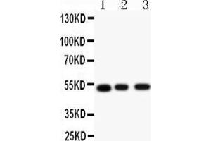 Anti-Muscarinic Acetylcholine Receptor 2 antibody, Western blotting All lanes: Anti Muscarinic Acetylcholine Receptor 2 () at 0. (Muscarinic Acetylcholine Receptor M2 Antikörper  (C-Term))