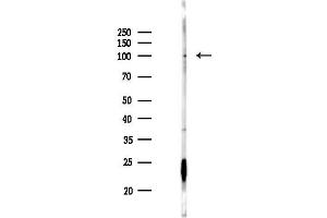 anti-Oxysterol Binding Protein-Like 5 (OSBPL5) antibody
