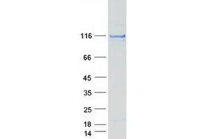 Western Blotting (WB) image for Coiled-Coil and C2 Domain Containing 1A (CC2D1A) protein (Myc-DYKDDDDK Tag) (ABIN2713269)
