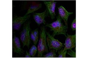 Image no. 2 for anti-V-Akt Murine Thymoma Viral Oncogene Homolog 1 (AKT1) (pThr450) antibody (ABIN319272)