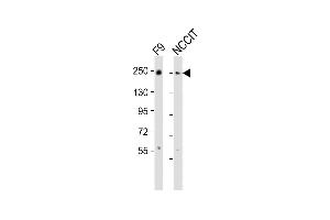 All lanes : Anti-PBRM1 Antibody (C-term) at 1:2000 dilution Lane 1: F9 whole cell lysates Lane 2: NCCIT whole cell lysates Lysates/proteins at 20 μg per lane. (Polybromo 1 Antikörper  (C-Term))