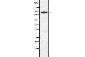 Western blot analysis SPAG5 using Jurkat whole cell lysates