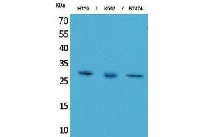 Western Blotting (WB) image for anti-Breast Cancer Metastasis-Suppressor 1-Like (BRMS1L) (C-Term) antibody (ABIN3178189) (BRMS1L Antikörper  (C-Term))