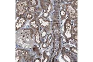 Immunohistochemical staining of human kidney with TMEM132C polyclonal antibody  shows cytoplasmic and membranous positivity in renal tubules. (TMEM132C Antikörper)