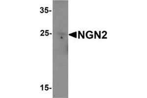Western blot analysis of NGN2 in rat brain tissue lysate with NGN2 Antibody  at 1 μg/mL