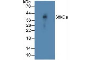 Western blot analysis of Rat Vein Tissue. (NOTCH4 Antikörper  (AA 1715-2001))