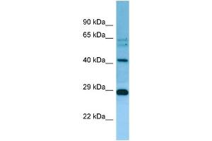 WB Suggested Anti-MRPL38 Antibody Titration: 1. (MRPL38 Antikörper  (C-Term))