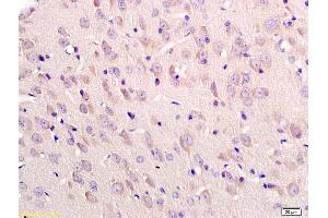 Formalin-fixed and paraffin embedded rat brain labeled with Anti-Tubulin-beta Polyclonal Antibody, Unconjugated (ABIN726320) at 1:200 followed by conjugation to the secondary antibody and DAB staining (TUBB Antikörper  (AA 1-50))