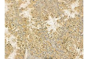 TUBA4A Mouse Monoclonal Antibody at 1/100 staining mouse testis tissue by IHC-P. (TUBA4A Antikörper)