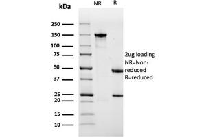 SDS-PAGE Analysis Purified Sarcomeric Actinin Alpha 2 Mouse MAb (ACTN2/3291). (ACTN2 Antikörper  (AA 557-692))