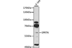 Western blot analysis of extracts of A-549 cells, using SPRTN antibody (ABIN6131456, ABIN6148389, ABIN6148391 and ABIN6215355) at 1:3000 dilution. (Spartan Antikörper  (AA 1-240))