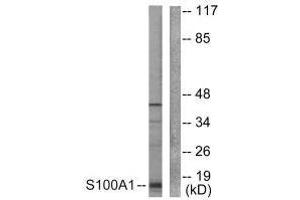 Western blot analysis of extracts from A549 cells, using S100 A1 antibody. (S100A1 Antikörper)