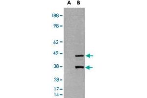 HEK293 overexpressing SIRT3 and probed with SIRT3 polyclonal antibody  (mock transfection in first lane), tested by Origene. (SIRT3 Antikörper)