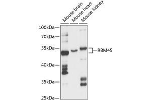 Western blot analysis of extracts of various cell lines, using RBM45 antibody (ABIN6128634, ABIN6146784, ABIN6146785 and ABIN6217980) at 1:3000 dilution. (RBM45 Antikörper  (AA 1-300))