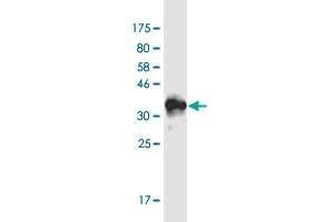 Western Blot detection against Immunogen (36. (RAI1 Antikörper  (AA 1-101))