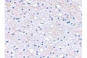 Immunohistochemical staining of human brain tissue using AP30163PU-N BRAL1 antibody at 2. (HAPLN2 Antikörper  (Center))