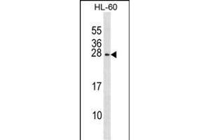 RGS2 Antibody (N-term) (ABIN1881749 and ABIN2839036) western blot analysis in HL-60 cell line lysates (35 μg/lane). (RGS2 Antikörper  (N-Term))