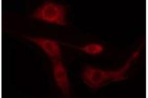ABIN6274434 staining LOVO cells by IF/ICC. (ARID1B Antikörper  (Internal Region))