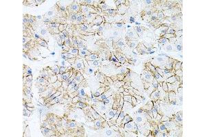 Immunohistochemistry of paraffin-embedded Human stomach using IL17A Polyclonal Antibody at dilution of 1:100 (40x lens). (Interleukin 17a Antikörper)