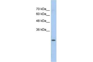 Western Blotting (WB) image for anti-Glutathione S-Transferase mu 1 (GSTM1) antibody (ABIN2462473) (GSTM1 Antikörper)