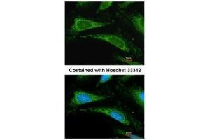 ICC/IF Image Immunofluorescence analysis of methanol-fixed HeLa, using Cyclophilin A, antibody at 1:200 dilution.