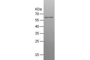 CKB Protein (AA 1-381) (His-IF2DI Tag)