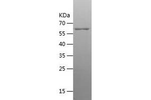 Western Blotting (WB) image for Creatine Kinase, Brain (CKB) (AA 1-381) protein (His-IF2DI Tag) (ABIN7122490) (CKB Protein (AA 1-381) (His-IF2DI Tag))