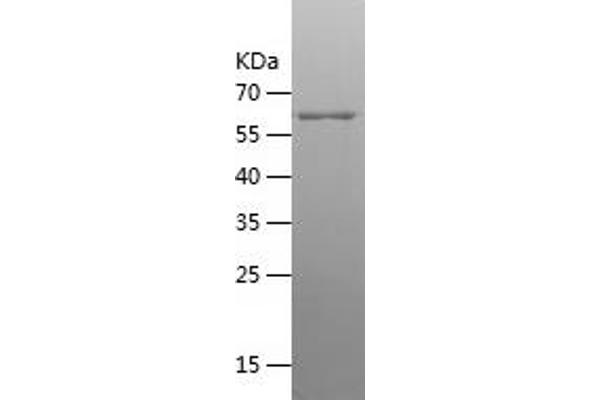 CKB Protein (AA 1-381) (His-IF2DI Tag)