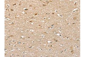 The image on the left is immunohistochemistry of paraffin-embedded Human brain tissue using ABIN7130610(PHLPP1 Antibody) at dilution 1/35, on the right is treated with fusion protein. (PHLPP1 Antikörper)