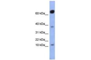 Image no. 1 for anti-NK6 Homeobox 3 (NKX6-3) (AA 71-120) antibody (ABIN6742923) (NK6 Homeobox 3 Antikörper  (AA 71-120))