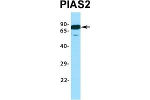 Western Blotting (WB) image for anti-Protein Inhibitor of Activated STAT, 2 (PIAS2) (C-Term) antibody (ABIN2776423)