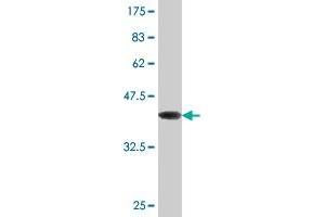 Western Blot detection against Immunogen (43. (TWIST2 Antikörper  (AA 1-160))