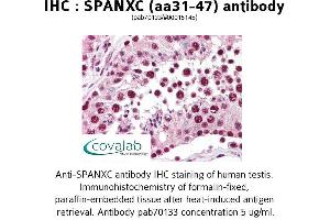 Image no. 1 for anti-SPANX Family, Member C (SPANXC) (AA 31-47) antibody (ABIN1739580) (SPANXC Antikörper  (AA 31-47))