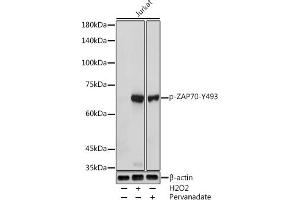 Western blot analysis of extracts of Jurkat cells, using Phospho-Z-Y493 antibody (ABIN3020534, ABIN3020535, ABIN3020536, ABIN1682145 and ABIN1682146) at 1:1000 dilution. (ZAP70 Antikörper  (pTyr493))