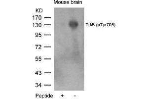 Image no. 1 for anti-Neurotrophic Tyrosine Kinase, Receptor, Type 2 (NTRK2) (pTyr705) antibody (ABIN319265) (TRKB Antikörper  (pTyr705))