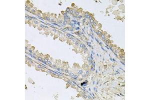 Immunohistochemistry of paraffin-embedded human prostate using PPIC antibody. (PPIC Antikörper  (AA 23-212))