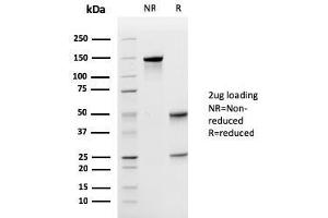 SDS-PAGE Analysis Purified Uroplakin 1A Mouse Monoclonal Antibody (UPK1A/2925). (UPK1A Antikörper  (AA 114-173))