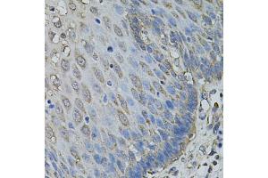 Immunohistochemistry of paraffin-embedded human esophagus using IL1A antibody (ABIN6291332) at dilution of 1:100 (40x lens). (IL1A Antikörper)