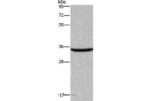 Western blot analysis of Human fetal brain tissue, using DKK3 Polyclonal Antibody at dilution of 1:200 (DKK3 Antikörper)