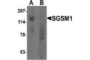 Western blot analysis of SGSM1 in human cerebellum tissue lysate with SGSM1 Antibody  at 1 μg/ml in (A) the absence and (B) the presence of blocking peptide. (SGSM1 Antikörper  (Middle Region))