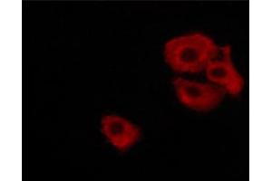 ABIN6267697 staining MKN-45 cells treated with Forskolin 30 μM, 20 min by ICC/IF.