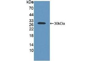 Detection of Recombinant ABCC2, Human using Polyclonal Antibody to ATP Binding Cassette Transporter C2 (ABCC2) (ABCC2 Antikörper  (AA 1300-1534))