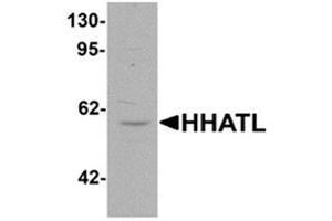 HHATL Antikörper  (N-Term)