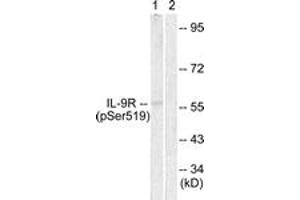 Western blot analysis of extracts from HuvEc cells, using IL-9R (Phospho-Ser519) Antibody.