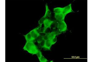 Immunofluorescence of purified MaxPab antibody to DTNA on 293 cell. (DTNA Antikörper  (AA 1-371))