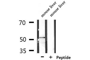 Western blot analysis of extracts from mouse liver, using RASGEF1C Antibody. (RASGEF1C Antikörper  (Internal Region))