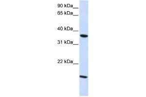 WB Suggested Anti-CLDN16 Antibody   Titration: 1. (Claudin 16 Antikörper  (C-Term))