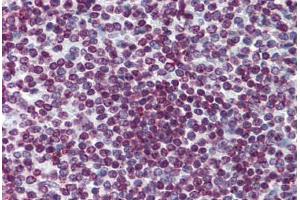 Human Spleen: Formalin-Fixed, Paraffin-Embedded (FFPE) (FOXO3 Antikörper  (AA 361-460))